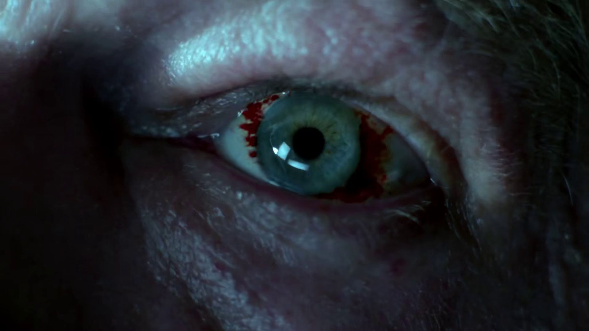 Connection: Blood vessels in Walter's eye